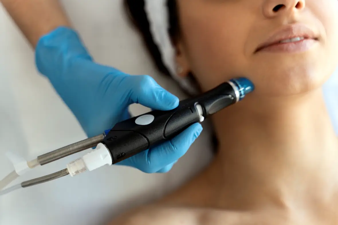 Dermapen imagen que representa y simboliza dermapen y refuerza el concepto del contenido Dermapen